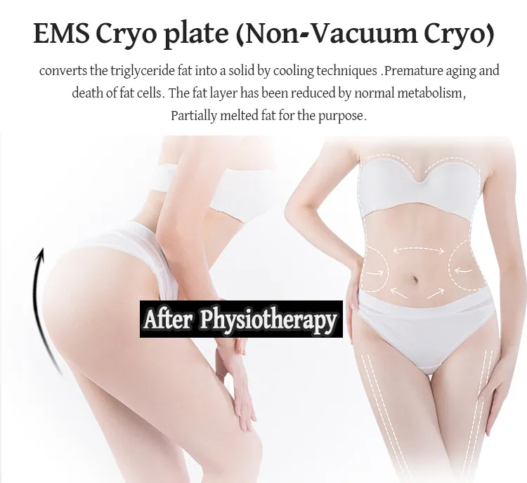 Tragbares Fettgefriergerät zur Körperformung, Entfernung von Cellulite, Kryotherapie-Gerät mit Kryoplatten und EMS
