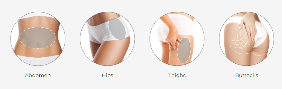 Bestes Preis-Kryolipolyse-Schlankheitsmaschine Kryotherapie Gewichtsreduktion Fett gefrieren