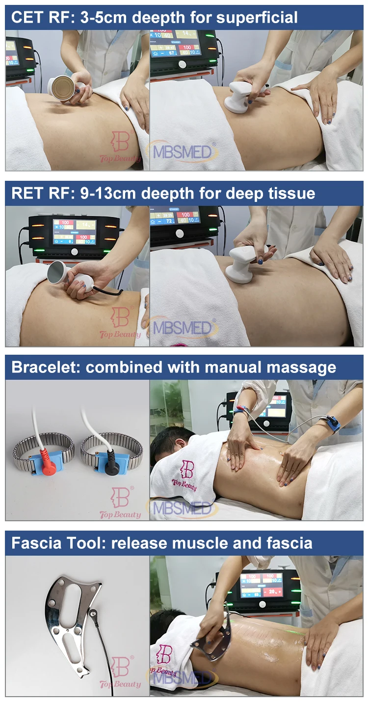 Indiba Radiofrequenz-Therapie Cet Ret Tecar Indiba 448Khz Tecar-Therapiegerät