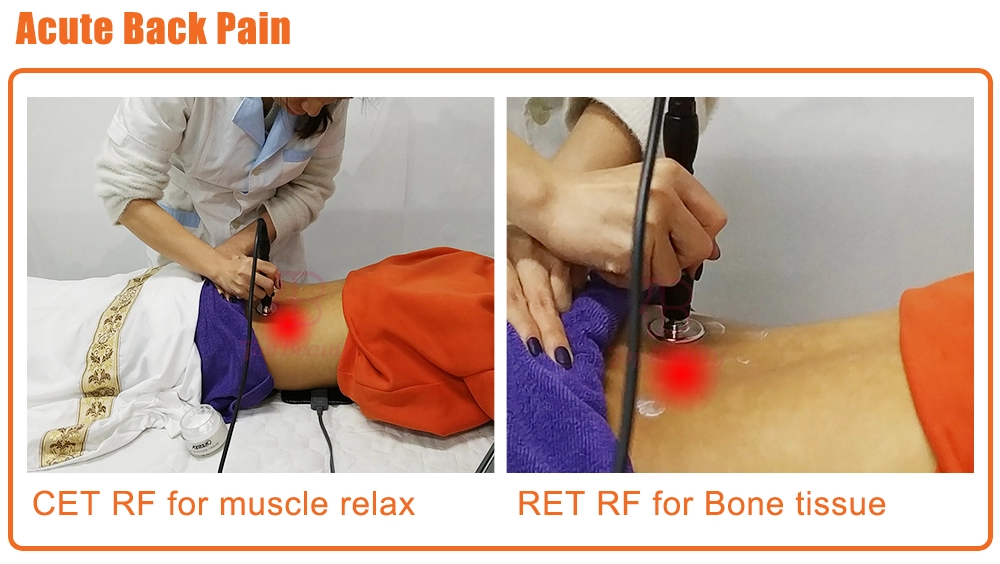 Tecar-Therapie Physio Monopolar RF resistive und kapazitive Maschine Tecarterapia Profesional