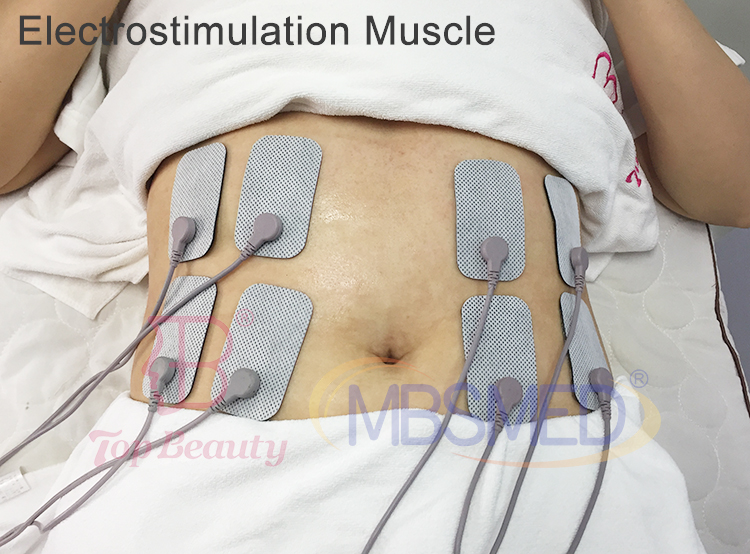 448KHZ Indiba Tecar Therapie Schmerzlinderung Indiba Radiofrequenz Elektro-Muskel-Stimulator Körpermodellierung Physiotherapie-Gerät
