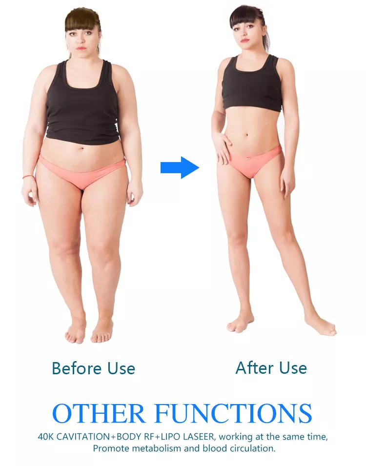 Neue Ankünfte 2022 tragbares Kryolipolyse 360 Fettgefrieren Cool Body Sculpting Maschine / 360 Kryolipolisis Maschine