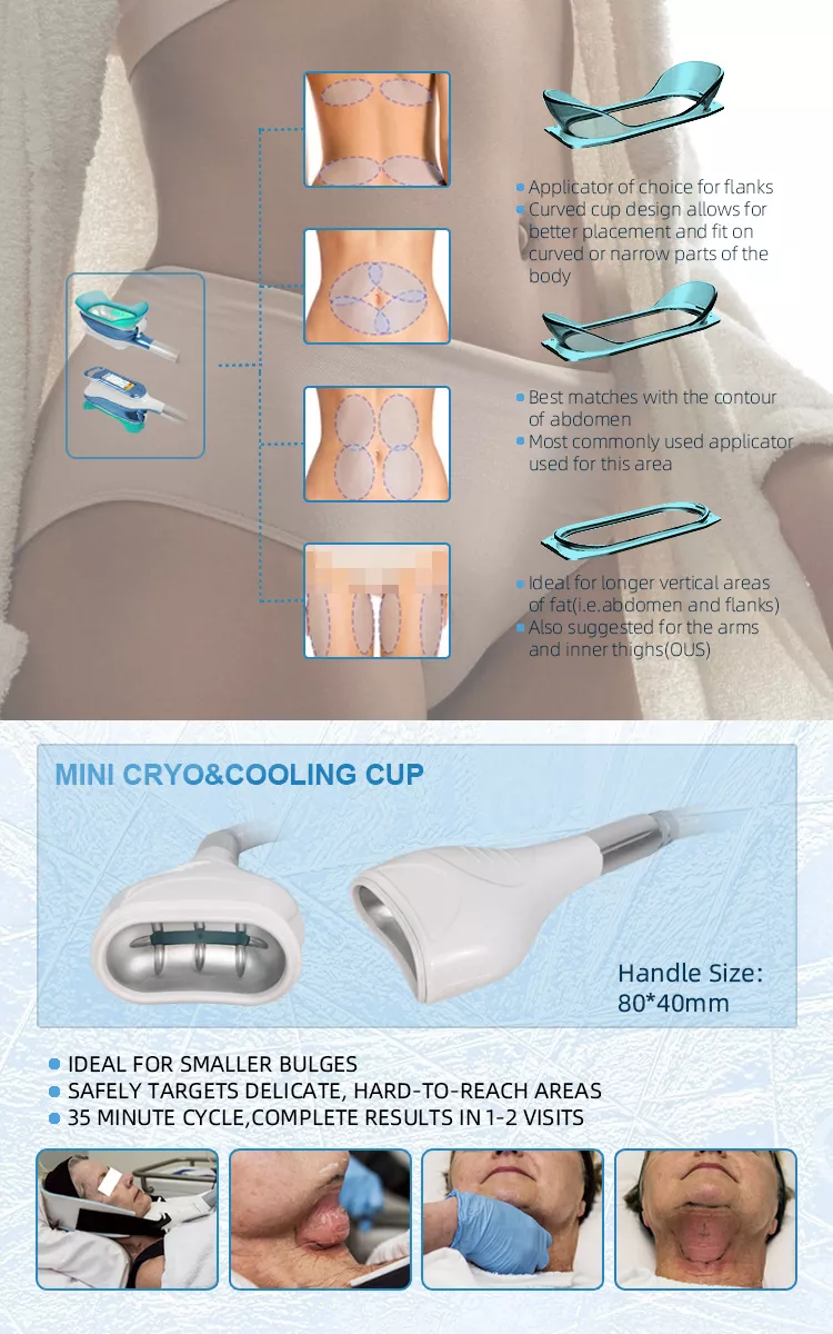 2022 Fabrikverkauf 360 Cryolipolysis Schlankheitsmaschine / Fettgefrieren Maschine Cool Tech Cellulite Reduktion
