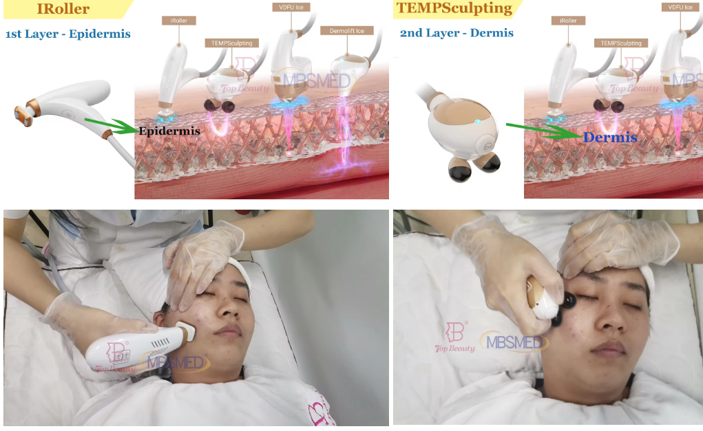 12D ICE HIFU-Gerät für Gesichtslifting, HIFU-Skin-Tightening-HIFU-Gerät