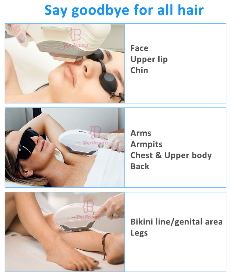 Neue Art von intensiver gepulster Lichttherapie IPL-Haarentfernungsgerät