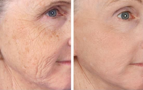 Professioneller Hersteller 1:1 Korea Gesicht Sauerstoff-Therapie-Maske Dome O2Toderm Oxgen Spray Jet Peel Oxigen Facial Machine