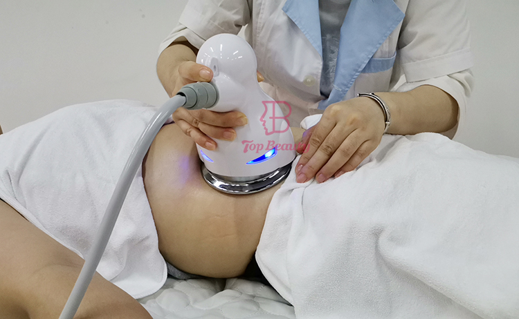 5D-Roller-Körpermodellierung Cellulite-Roller Endosferas-Slimming-Vakuum-Therapiegerät