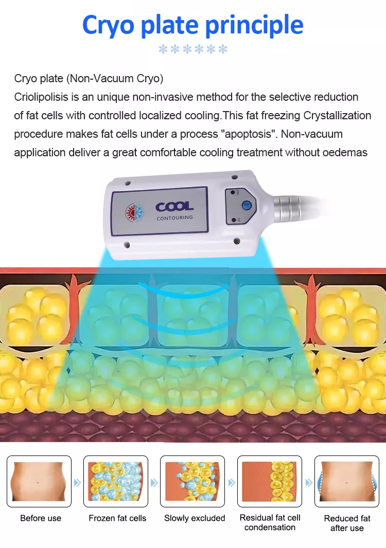 2023 Neue Fettverlust-Cryopads Schlankheitsmaschine Cryolipolyse-Maschine Coldtec Fett-Freeze Cryolipolyse-Gerät