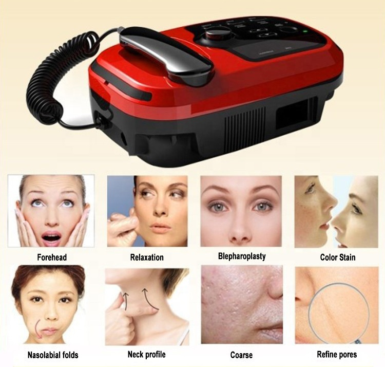 Bestes Gerät zur Entfernung von Dehnungsstreifen mit monopolarem RF-Skin-Tightening mittels Radiowellen