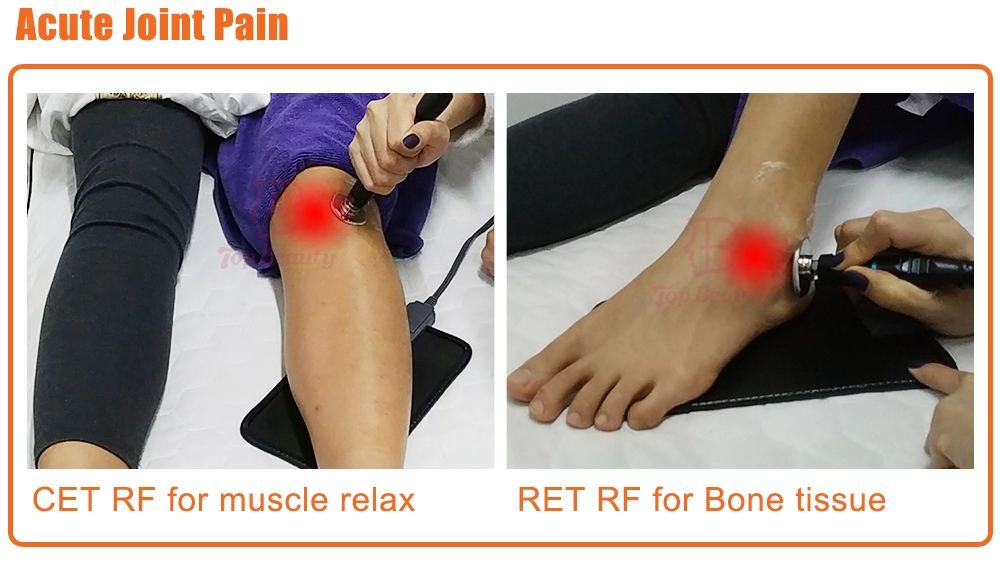 Tecar-Therapie Physio Monopolar RF resistive und kapazitive Maschine Tecarterapia Profesional