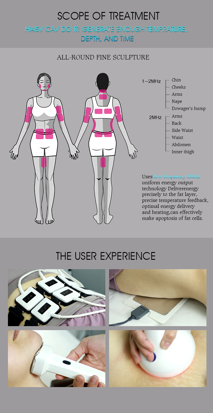 3 in 1 Salon Verwendung Trusculpt Id Flex Rf Körperkonturierung Körpermodellierung 2mhz Cellulite Behandlung Fett Reduzierung Trufat Maschine