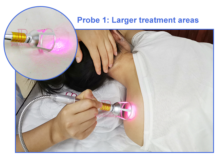 Bild der Lasertherapie-Anwendung