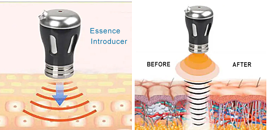 2 in 1 RF-Schönheitsimportgerät EMS-Schönheitsprodukt-Maschine Anti-Aging-Gesichtslifting-Gerät Faltenentfernung Ultraschall-EMS-Therapiegerät
