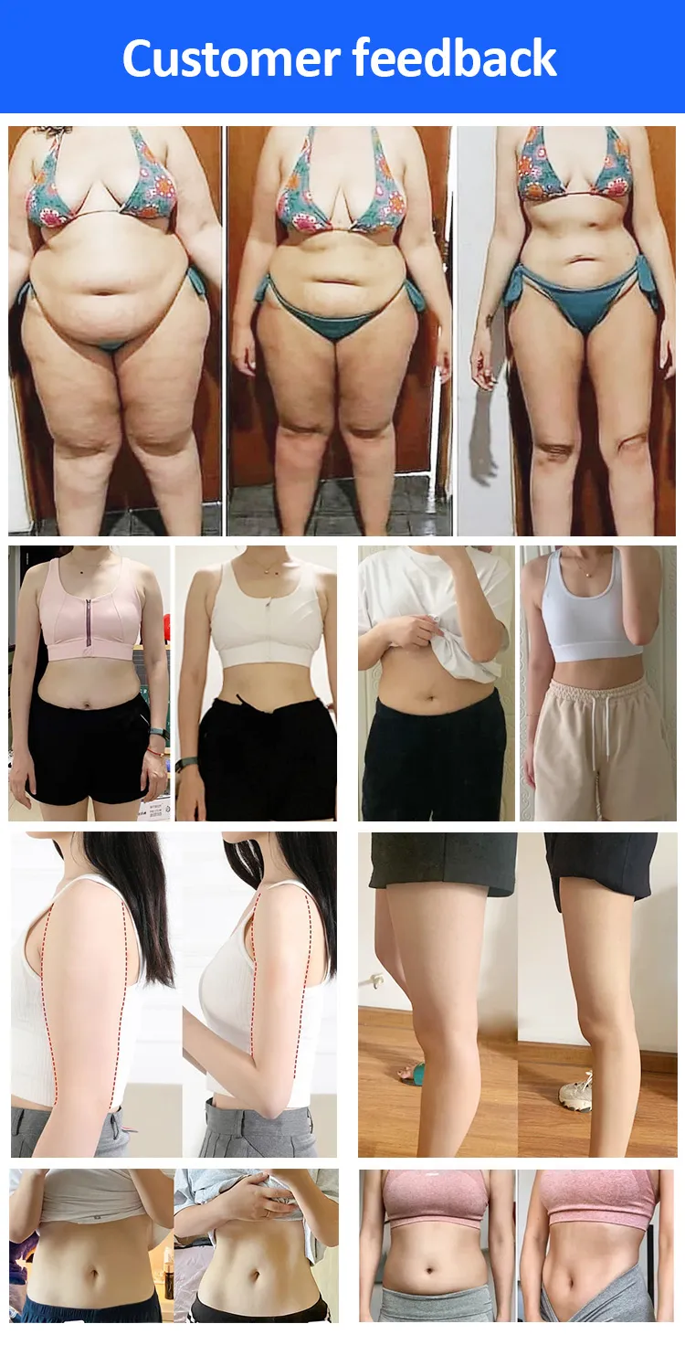 Tragbares Fettgefriergerät zur Körperformung, Entfernung von Cellulite, Kryotherapie-Gerät mit Kryoplatten und EMS