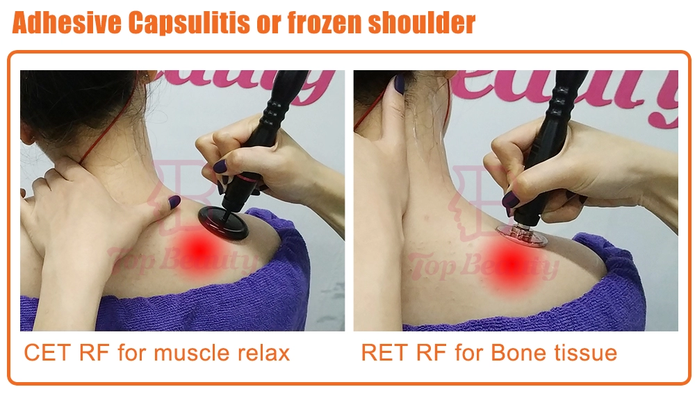 Tecar-Therapie Physio Monopolar RF resistive und kapazitive Maschine Tecarterapia Profesional