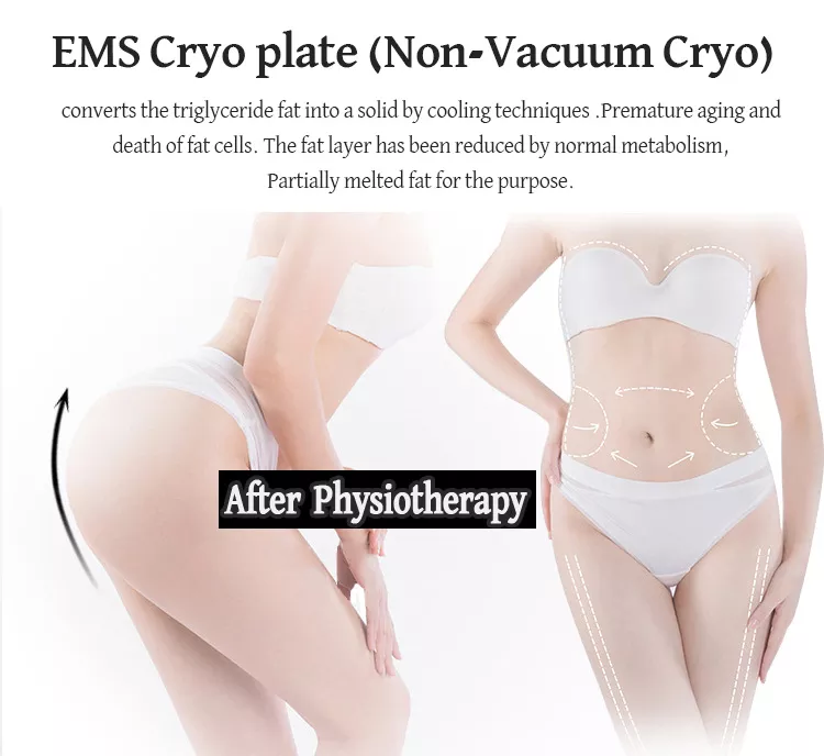2023 Neue schmerzlose Cryolipolyse Bauchstraffung Cryo-Platte Kühlpads Fettgefrieren EMS-Maschine