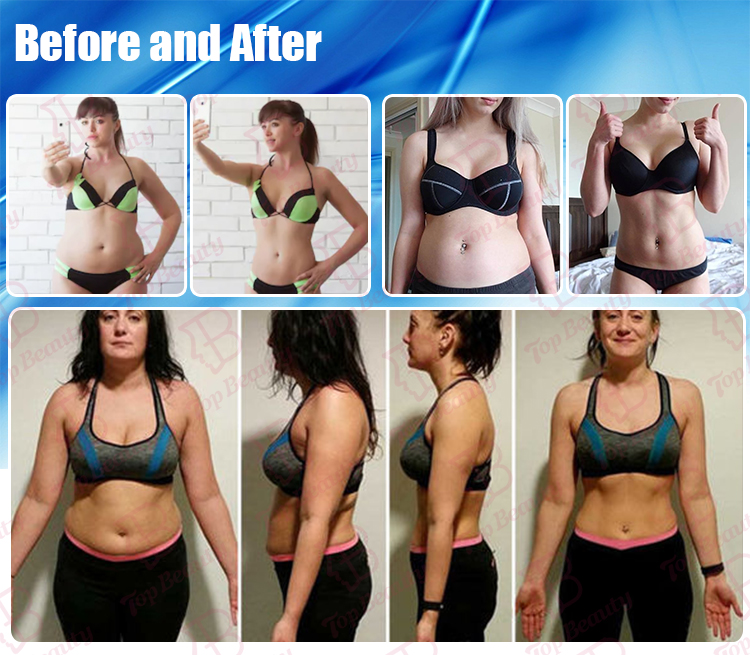 Lipo Kavitations Maschine 80k Kavitations Schlankheitsmaschine Vakuum Kavitations System Liposuktion Kim 8 Schlankheits System -