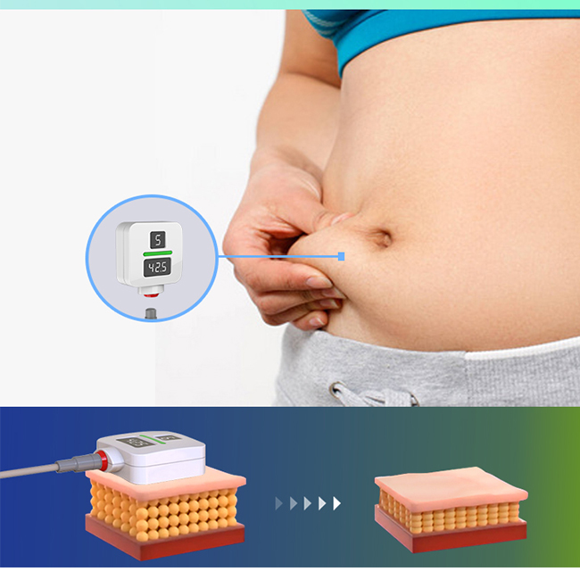 Trushape ID Behandlung Ems Elektrische Muskelstimulation Körperformung Emslim Maschine