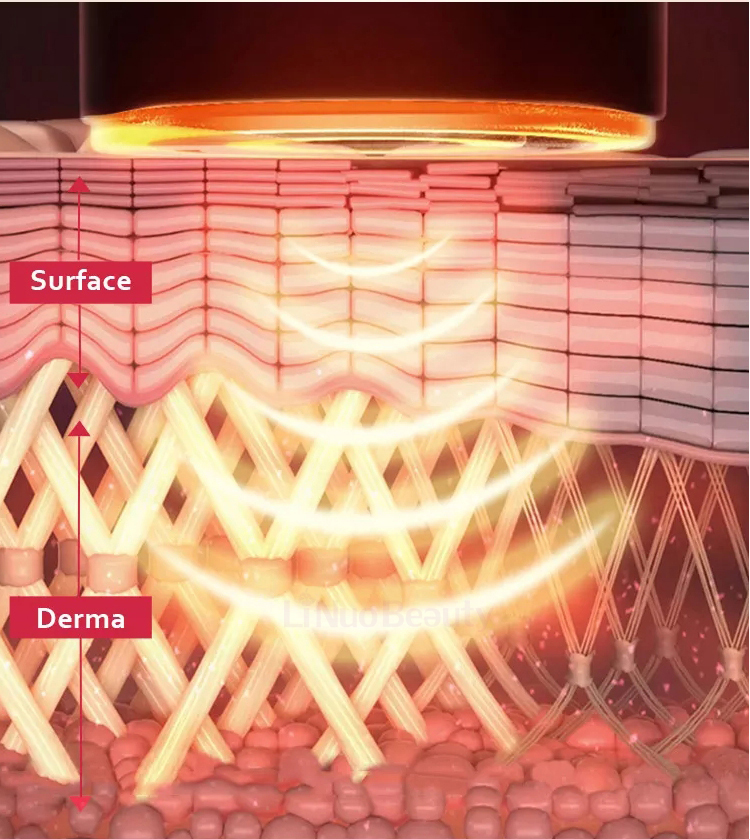 Neueste Mikro-Nadling-RF-Maschine Gesichtspflege Hautverjüngung Secret RF 4 Nadeln Akne-Narben-Behandlung RF Fractional Mikro-Nadel