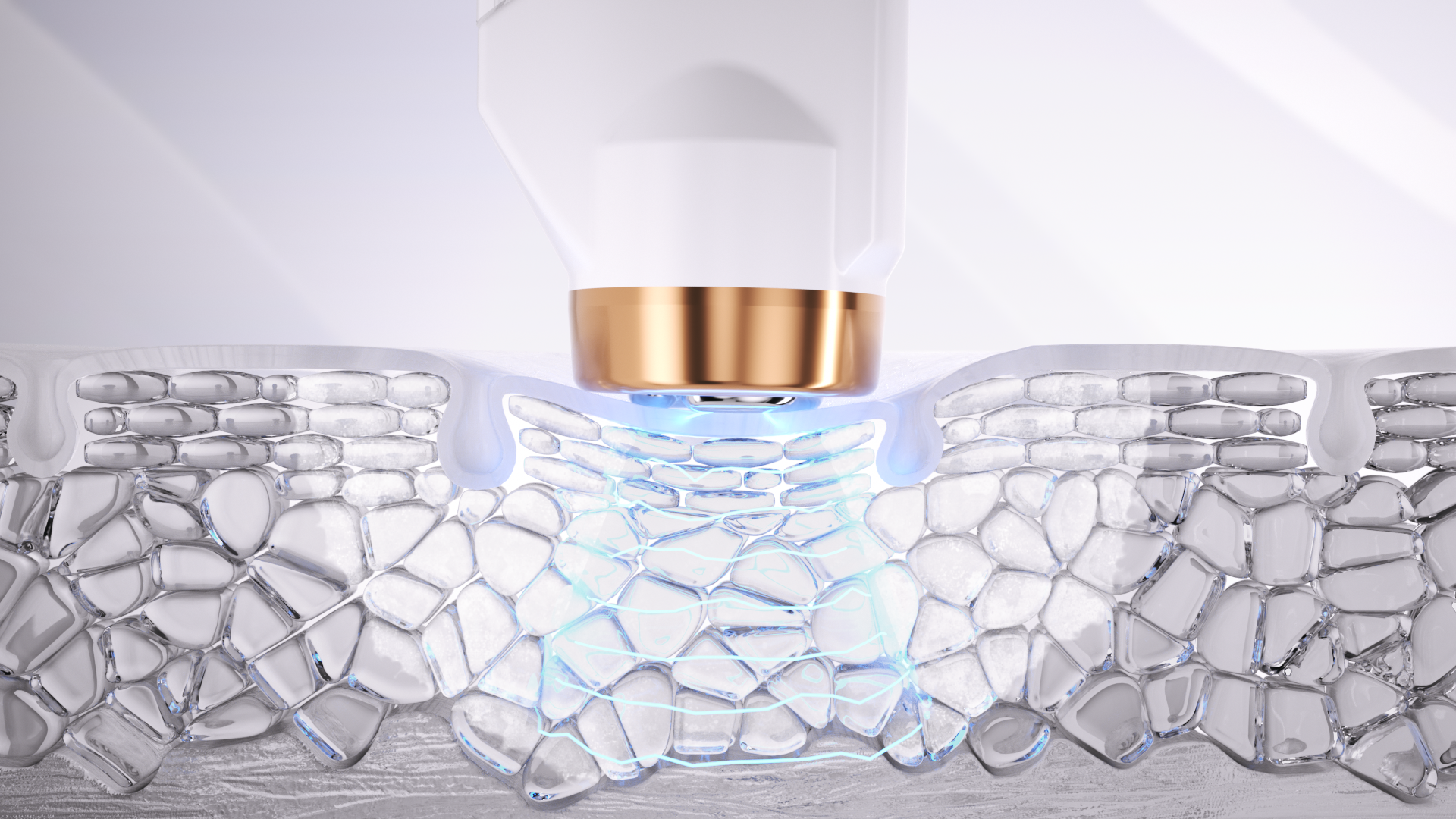 Schritt 3 Hautinfusion