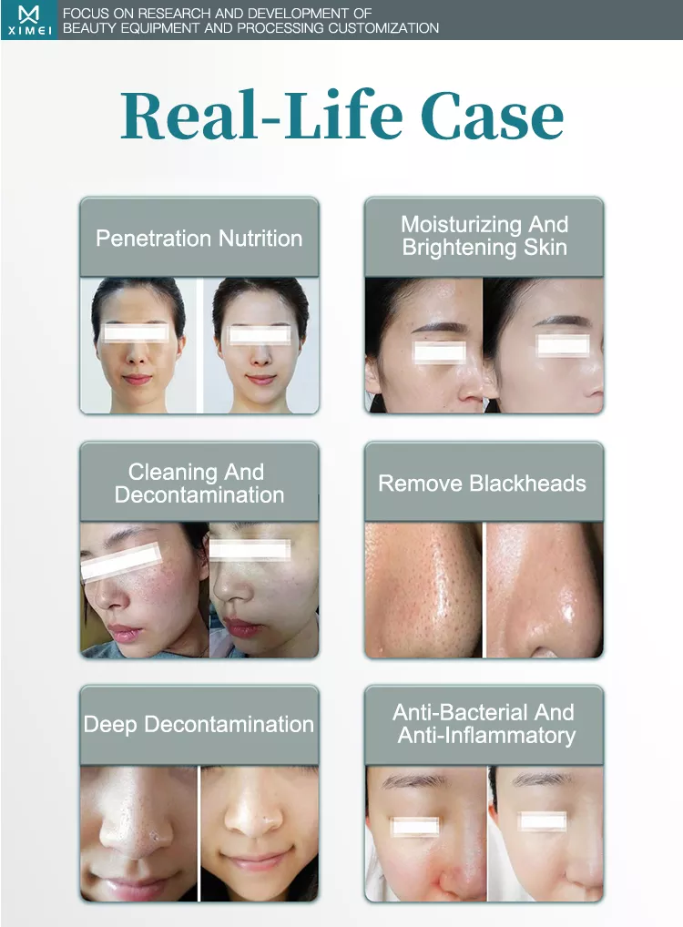 6 in 1 Aqua-Gesicht-Jet-Peel-Vakuum-Gesicht-Reinigung Hydro-Dermabrasion-Gerät für SPA