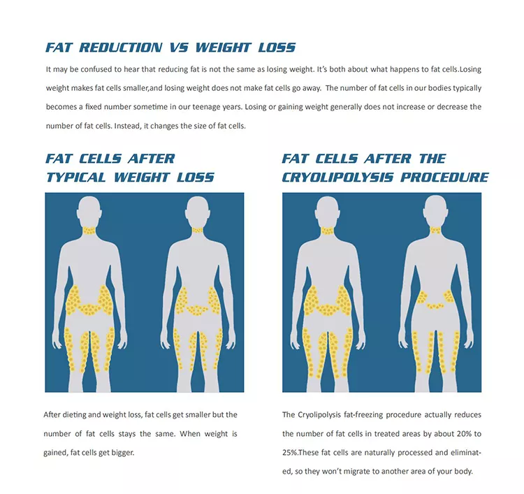 2022 Fabrikverkauf 360 Cryolipolysis Schlankheitsmaschine / Fettgefrieren Maschine Cool Tech Cellulite Reduktion