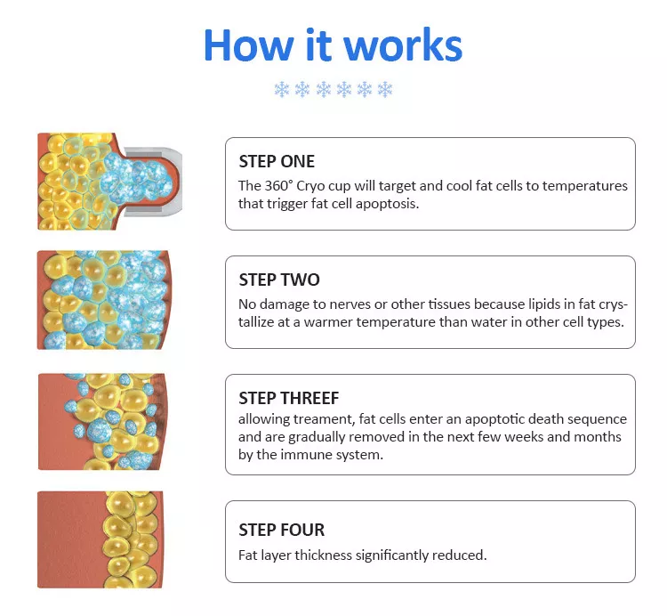 2022 Fabrikverkauf 360 Cryolipolysis Schlankheitsmaschine / Fettgefrieren Maschine Cool Tech Cellulite Reduktion