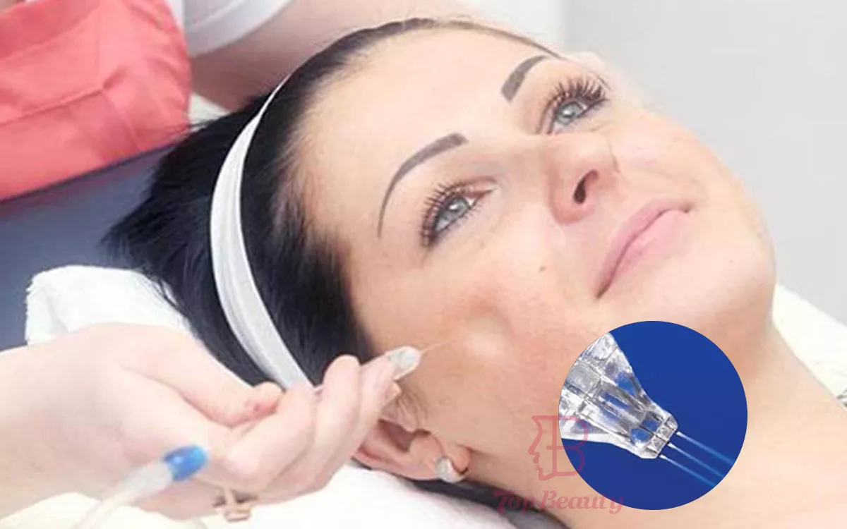Weitere Darstellung des Oxygen-Jet-Peelings