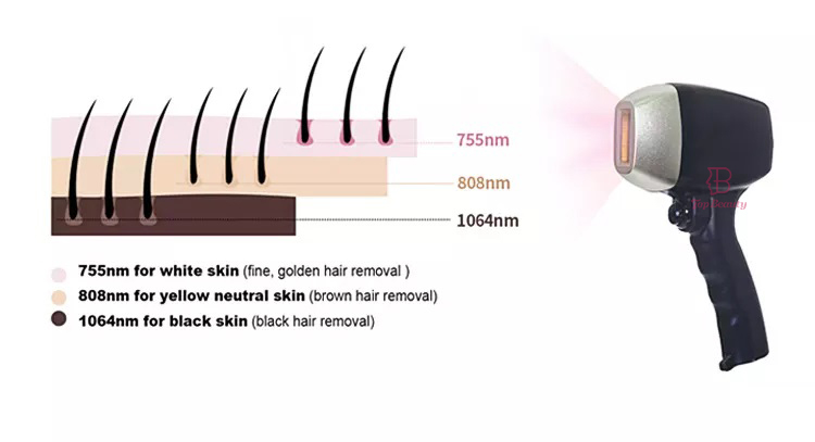 Professionelle 808nm-Diodenlaser-Haarentfernungsmaschine