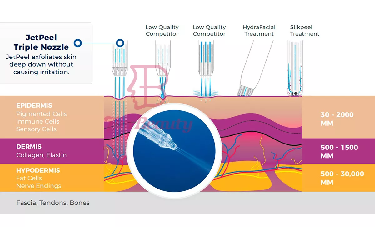 Bild des Oxygen-Jet-Peelings