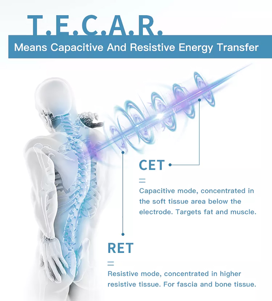 Bild zur Tecar-Therapie