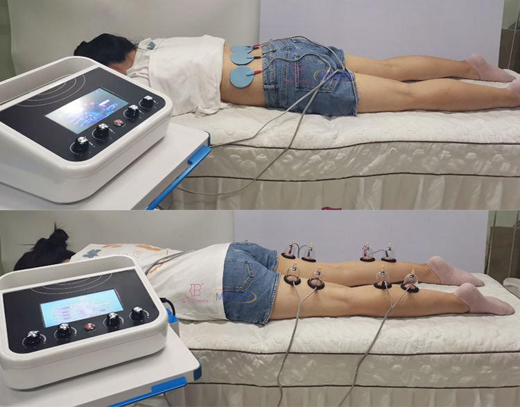 EMS-Muskelstimulator Körperstraffung Russische Welle Elektrostimulation Fair Cupping Brust Vakuum-Therapiegerät