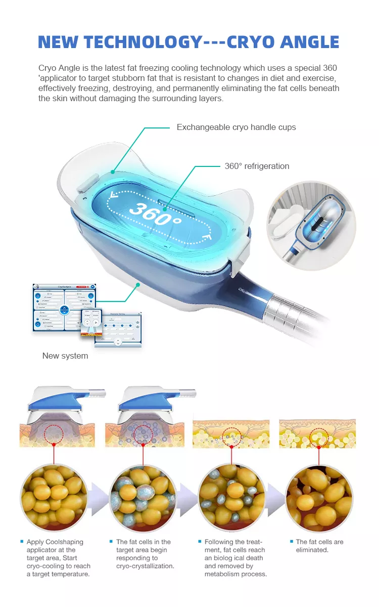 2022 360 Kryo-Maschine Kryolipolyse Bestpreis Fettgefrier-Maschine zur Gewichtsreduktion Kryolipolyse