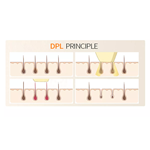 Dioden-Epilationsgerät DPL-Photonen-Hautverjüngung, -straffung und -faltenreduktion sowie Schönheitsgerät