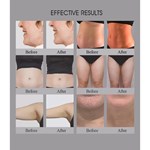 3 in 1 Salon Verwendung Trusculpt Id Flex Rf Körperkonturierung Körpermodellierung 2mhz Cellulite Behandlung Fett Reduzierung Trufat Maschine