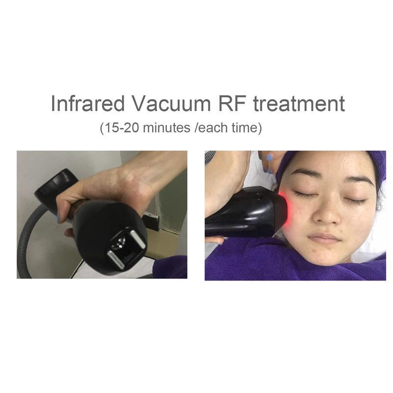 2023 Neu eingetroffener Vakuum-Roller-Massage-Body-Shaper zur Fettreduktion und Körperstraffung
