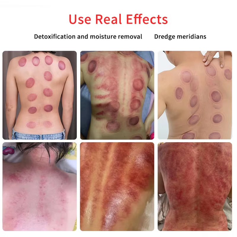 EMS-Muskelstimulator Körperstraffung Russische Welle Elektrostimulation Fair Cupping Brust Vakuum-Therapiegerät