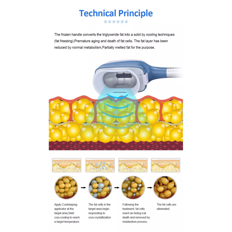2022 Fabrikverkauf 360 Cryolipolysis Schlankheitsmaschine / Fettgefrieren Maschine Cool Tech Cellulite Reduktion