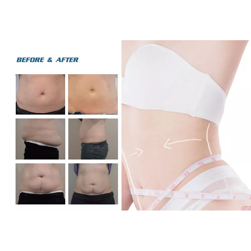 2022 Fabrikverkauf 360 Cryolipolysis Schlankheitsmaschine / Fettgefrieren Maschine Cool Tech Cellulite Reduktion