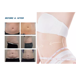 2022 Fabrikverkauf 360 Cryolipolysis Schlankheitsmaschine / Fettgefrieren Maschine Cool Tech Cellulite Reduktion