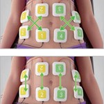 Professionelles Trusculpt ID EMS elektrisches Muskelstimulation Körperformer-Gerät