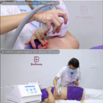 1.000.000 Schüsse 8D Ice Cooling HIFU 5D Smas Lifting Ice Skin Care Beauty Maschine