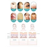 Professionelles Rf Microneedling Narbenentfernung Hautstraffung Mikro Nadling Maschine