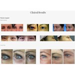 Schönheits-Plasma-Pen-Eye-Lift-Maschine Jet-Plasma-Lift für Hautbehandlung Akne-Maschine