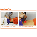 Tecar-Therapie Physio Monopolar RF resistive und kapazitive Maschine Tecarterapia Profesional