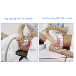 Korea Kühlung RF-Butt-Lift-Körpermodellierung Massage RF-Gesichtslifting Körperstraffungsgerät
