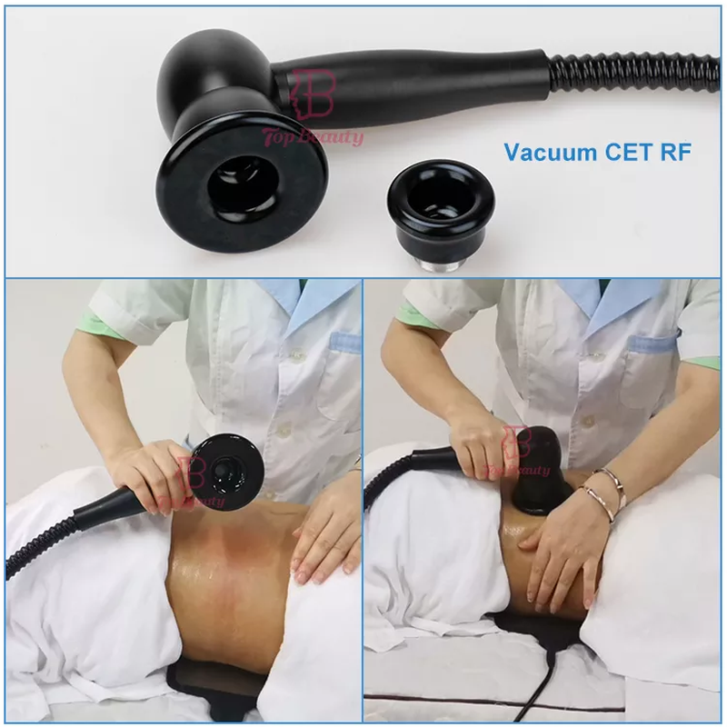 448khz Vakuum-Rf-Tecar-Therapiegerät Indiba Rf Faltenentfernung Körperstraffungsgerät Radiofrequenz