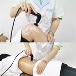 Indiba Diathermie Tecarterapia Smart Machine Rf Tiefenfettverbrennung Tecar Physiotherapie