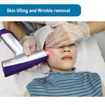 Radiofrequenz (RF) Microneedling Matrix Pros Hautfaltenentfernung