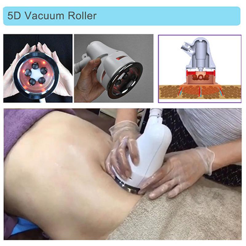 5D Vakuum-Infrarot-Roller zur Cellulite-Reduktion
